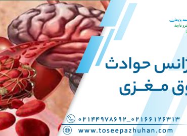 اورژانس حوادث عروق مغزی